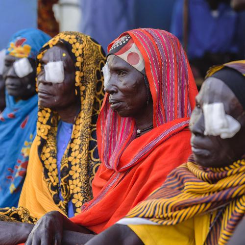 ladies post cataract surgery